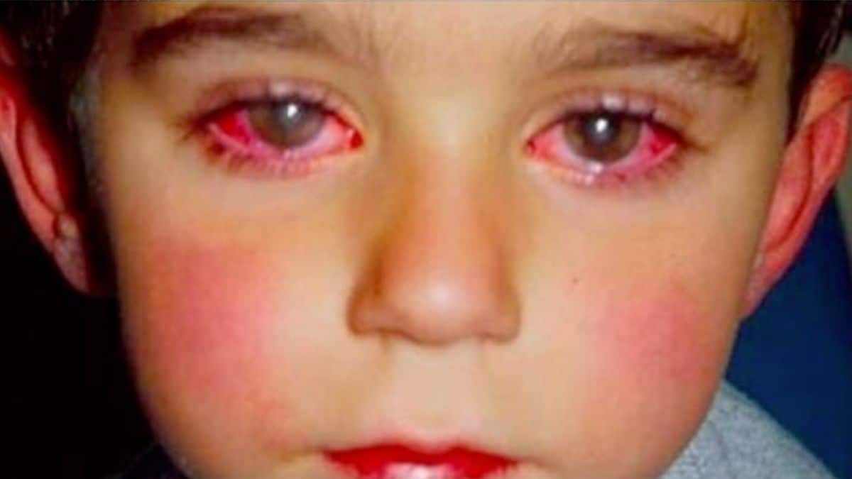 Cet enfant perd 75 % de sa vue à cause d’un jouet que tout le monde a chez soi